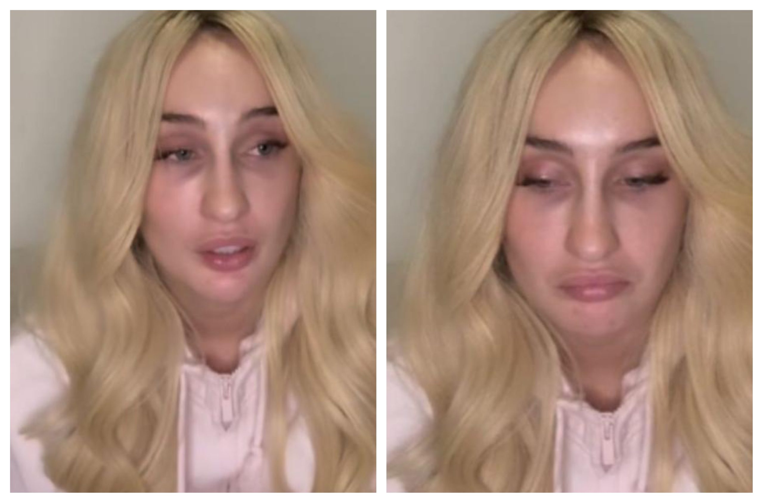 Fran Maira se refiere a accidente donde un motorista resultó gravemente herido: «No encontraba salida»