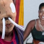 Colombiana quemada con ácido ruega por eutanasia tras 26 años de suplicio y casi 90 cirugías | Sociedad