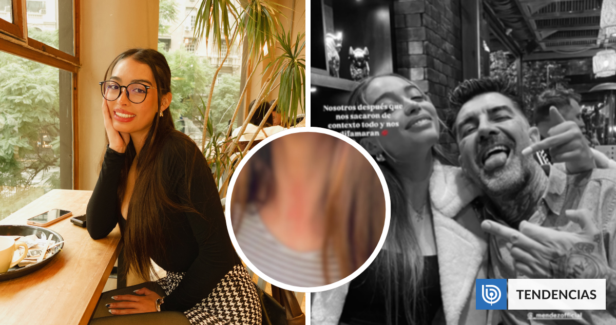 Issis, hija de DJ Méndez, mostró marcas en su cuello tras violento intento de asalto: «Fue horrible» | TV y Espectáculo