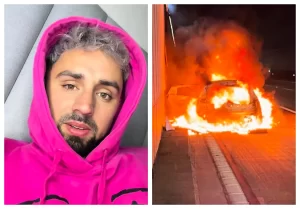 «Se quemó por completo»: Bambino de Gran Hermano relata el impactante accidente que sufrió