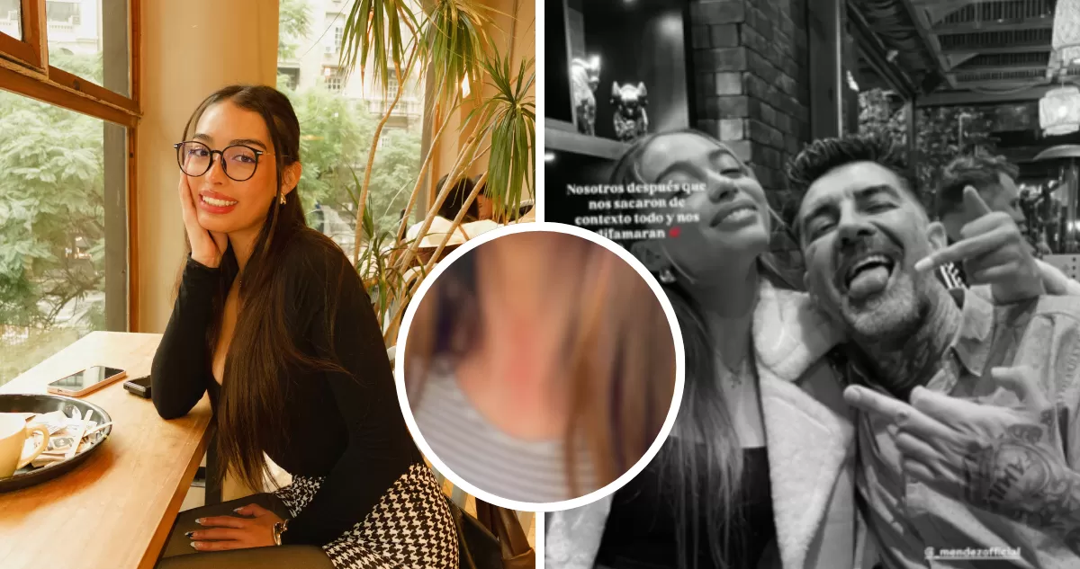 Issis, hija de DJ Méndez, mostró marcas en su cuello tras violento intento de asalto: «Fue horrible» | TV y Espectáculo